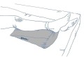 Stabilizator podudzia P-SS-06 StabiloBed   -   REH4MAT.jpg