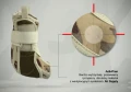Orteza stawu skokowego z łuskami anatomicznymi 4ARMY-SS-02  - REH4MAT.jpg