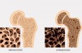 Orteza biodra z funkcją termoterapii AM-SB-03  -  4MEDIC.jpg