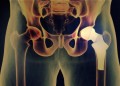 Uniwersalna orteza stawu biodrowego AM-SB-05  -  4MEDIC.jpg
