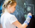 Dziecięca otwarta orteza ręki i przedramienia AM-OSN-U-01  -  4KIDS.jpg